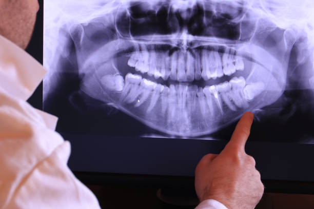 Best Broken or Chipped Tooth Repair in Huron, OH