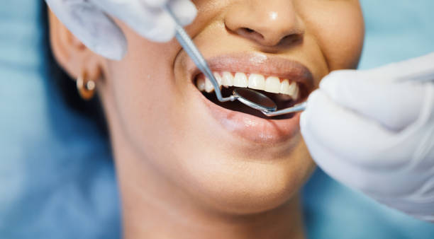 Best Emergency Denture Repair in Huron, OH