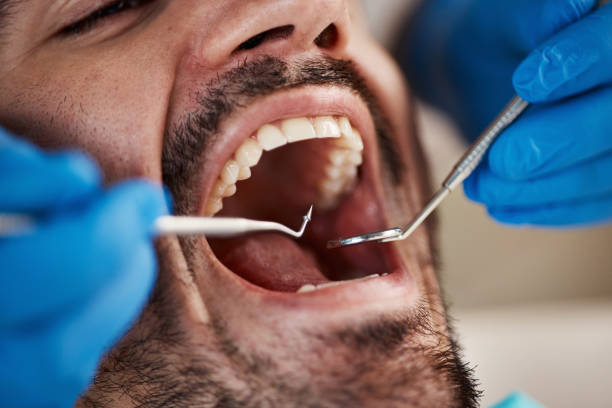 Best Emergency Cosmetic Dentistry (e.g., broken veneers) in Huron, OH